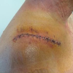 Alain-Patrice bas TRUMP